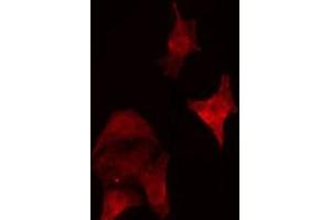 ABIN6279792 staining HepG2 cells by IF/ICC. (Septin 5 antibody  (Internal Region))