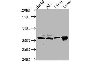 Western Blot Positive WB detected in: HepG2 whole cell lysate, PC-3 whole cell lysate, Rat liver tissue, Mouse liver tissue All lanes: E2F5 antibody at 5 μg/mL Secondary Goat polyclonal to rabbit IgG at 1/50000 dilution Predicted band size: 38, 21 kDa Observed band size: 38 kDa (E2F5 antibody  (AA 193-298))