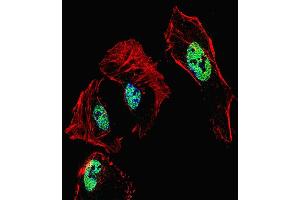 Fluorescent confocal image of Hela cell stained with RARB Antibody (Center) (ABIN1537931 and ABIN2849656). (Retinoic Acid Receptor beta antibody  (AA 168-195))