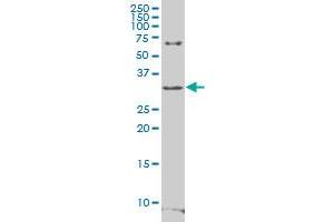 RFPL4B polyclonal antibody (A01), Lot # 060703JCS1. (RFPL4B antibody  (AA 127-226))