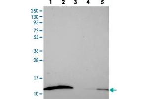 Western blot analysis of Lane 1: RT-4, Lane 2: U-251 MG, Lane 3: Human Plasma, Lane 4: Liver, Lane 5: Tonsil with S100A16 polyclonal antibody  at 1:250-1:500 dilution. (S100A16 antibody)