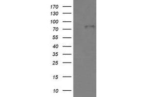 Image no. 1 for anti-Bone Morphogenetic Protein 1 (BMP1) (AA 225-617) antibody (ABIN1491232) (BMP1 antibody  (AA 225-617))