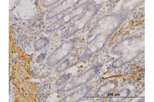 Immunoperoxidase of monoclonal antibody to MYOC on formalin-fixed paraffin-embedded human small Intestine. (MYOC antibody  (AA 36-135))