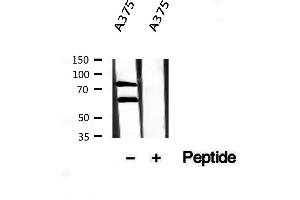 Western blot analysis of extracts from A375, using Melanophilin antibody. (Melanophilin antibody  (C-Term))