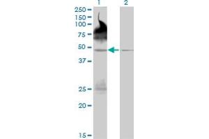 Western Blot analysis of PALM2 expression in transfected 293T cell line by PALM2 monoclonal antibody (M09), clone 1A8. (Paralemmin 2 antibody  (AA 321-411))