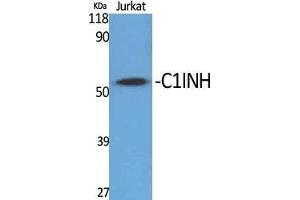 Western Blot (WB) analysis of specific cells using C1INH Polyclonal Antibody.