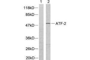 Western blot analysis of extracts from LOVO cells using ATF-2 (Ab-73 or 55) antibody (E021032). (ATF2 antibody)