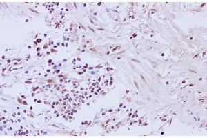 Immunohistochemistry of paraffin-embedded Human muscularis mucosa of the colon tissue using CCNL2 Polyclonal Antibody at dilution of 1:200 (Cyclin L2 antibody)