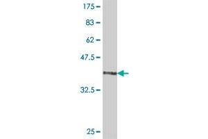 Western Blot detection against Immunogen (37 KDa) . (VPS9D1 antibody  (AA 157-255))