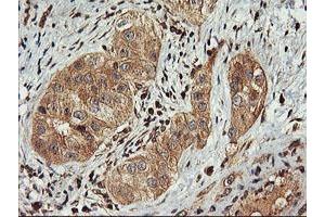 Image no. 9 for anti-F-Box Protein 21 (FBXO21) antibody (ABIN1498234)