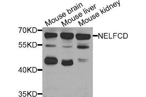 Western Blotting (WB) image for anti-TH1-Like (TH1L) (AA 355-599) antibody (ABIN6220747) (TH1-Like antibody  (AA 355-599))