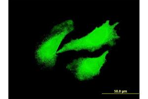 Immunofluorescence of monoclonal antibody to DYX1C1 on HeLa cell. (DYX1C1 antibody  (AA 336-420))