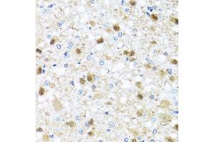 Immunohistochemistry of paraffin-embedded rat brain using ZBTB17 antibody (ABIN5974597) at dilution of 1/100 (40x lens). (ZBTB17 antibody)