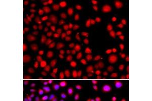 Immunofluorescence analysis of A549 cells using HLX Polyclonal Antibody (HLX antibody)