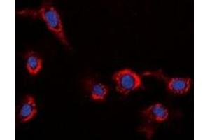 Immunofluorescent analysis of HER2 staining in HeLa cells. (ErbB2/Her2 antibody)