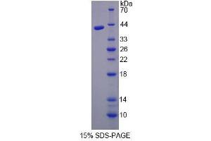 Image no. 1 for Aminolevulinate Dehydratase (ALAD) (AA 1-330) protein (His tag) (ABIN4989136)