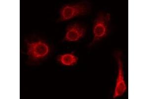 TMEM185A Antikörper