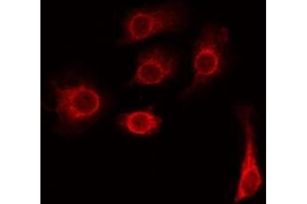 TMEM185A Antikörper