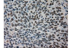 Immunohistochemical staining of paraffin-embedded Ovary tissue using anti-TMEM100mouse monoclonal antibody. (TMEM100 antibody)