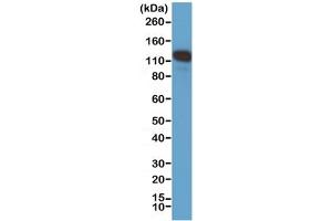 Western Blotting (WB) image for anti-Melanoma Cell Adhesion Molecule (MCAM) (C-Term) antibody (ABIN4953302)