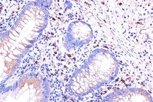 Immunohistochemistry of paraffin-embedded human appendix using C5 Rabbit pAb (ABIN6127535, ABIN6137777, ABIN6137778 and ABIN6219037) at dilution of 1:100 (40x lens). (C5AR1 antibody  (AA 250-350))