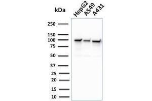 Western Blot Analysis of human HepG2, A549, and A431 cell lysate using MSH2 Mouse Monoclonal Antibody (MSH2/2622). (MSH2 antibody  (AA 327-427))