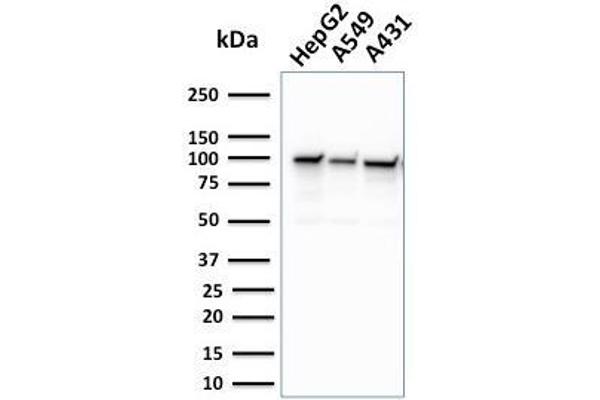 MSH2 Antikörper  (AA 327-427)