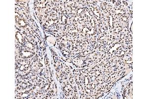 IHC analysis of SSB using anti-SSB antibody (ABIN7602125).