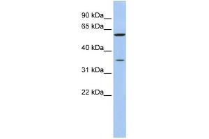 WB Suggested Anti-AKR1B1 Antibody Titration: 0. (AKR1B1 antibody  (N-Term))