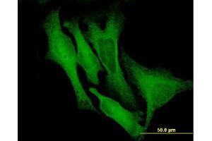 Immunofluorescence of monoclonal antibody to DCX on HeLa cell. (Doublecortin antibody  (AA 1-360))