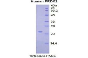 SDS-PAGE of Protein Standard from the Kit  (Highly purified E. (Peroxiredoxin 2 ELISA Kit)