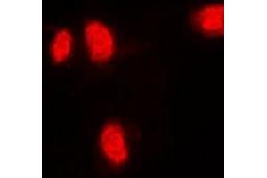 Immunofluorescent analysis of RANGAP1 staining in MCF7 cells. (RANGAP1 antibody)