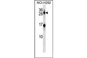 Western blot analysis of KLK14 Antibody (N-term) in NCI-H292 cell line lysates (35ug/lane). (Kallikrein 14 antibody  (N-Term))