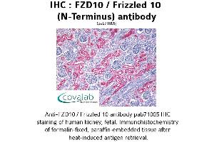 Image no. 1 for anti-Frizzled Family Receptor 10 (FZD10) (Extracellular Domain), (N-Term) antibody (ABIN1734497) (FZD10 antibody  (Extracellular Domain, N-Term))