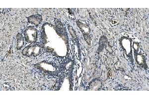 IHC analysis of Carbonic Anhydrase I/CA1 using anti-Carbonic Anhydrase I/CA1 antibody (ABIN7602621).