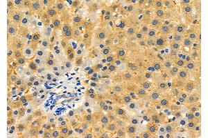 ABIN6265484 and ABIN6276350 at 1/100 staining Rat liver tissue by IHC-P.