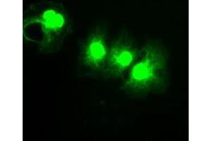 Image no. 5 for anti-P450 (Cytochrome) Oxidoreductase (POR) antibody (ABIN1497742) (POR antibody)