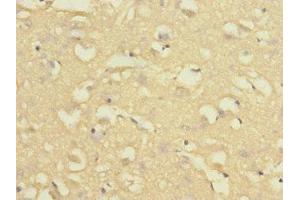 Immunohistochemistry of paraffin-embedded human brain tissue using ABIN7161622 at dilution of 1:100 (Nischarin antibody  (AA 500-700))