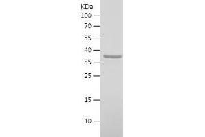 SHoc2/Sur8 Protein (AA 1-96) (His-IF2DI Tag)
