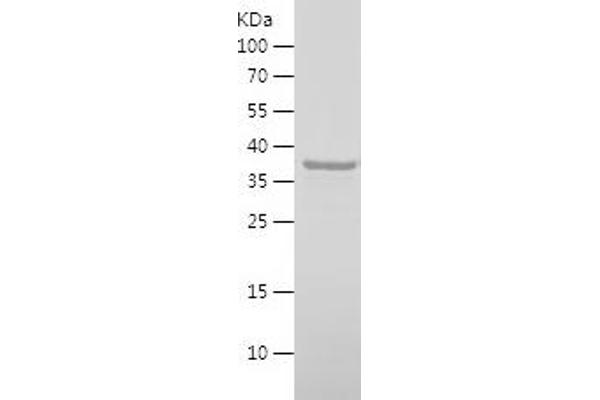SHoc2/Sur8 Protein (AA 1-96) (His-IF2DI Tag)