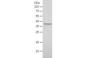 Western Blotting (WB) image for Leucine-rich repeat protein SHOC-2 (SHOC2) (AA 1-96) protein (His-IF2DI Tag) (ABIN7282778) (SHoc2/Sur8 Protein (AA 1-96) (His-IF2DI Tag))