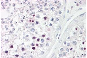 Anti-RFX3 antibody IHC staining of human testis. (RFX3 antibody  (AA 641-690))