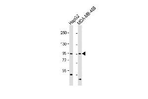 All lanes : Anti-OPHN1 Antibody (Center) at 1:1000 dilution Lane 1: HepG2 whole cell lysate Lane 2: MDA-MB-468 whole cell lysate Lysates/proteins at 20 μg per lane. (Oligophrenin 1 antibody  (AA 284-315))