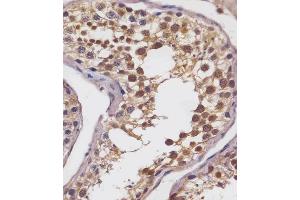 (ABIN6242872 and ABIN6578693) staining SLC2A8 in human testis tissue sections by Immunohistochemistry (IHC-P - paraformaldehyde-fixed, paraffin-embedded sections).