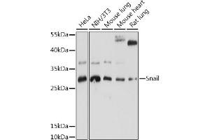 Western blot analysis of extracts of various cell lines, using Snail antibody (ABIN6134928, ABIN6148176, ABIN6148179 and ABIN6215911) at 1:1000 dilution. (SNAIL antibody  (C-Term))