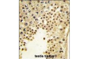 Formalin-fixed and paraffin-embedded human testis tissue reacted with JHDM1a/FBXL11 antibody (Center) (ABIN387896 and ABIN2844142) , which was peroxidase-conjugated to the secondary antibody, followed by DAB staining. (KDM2A antibody  (AA 500-527))