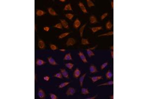 Immunofluorescence analysis of L929 cells using C antibody (ABIN7266029) at dilution of 1:100. (CAMSAP1 antibody  (AA 350-650))