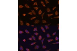 Immunofluorescence analysis of L929 cells using C antibody (ABIN7266029) at dilution of 1:100. (CAMSAP1 antibody  (AA 350-650))