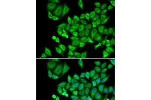 Immunofluorescence analysis of U2OS cells using DHRS9 Polyclonal Antibody (DHRS9 antibody)
