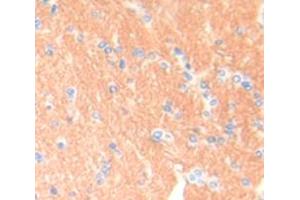 Figure. (BRCA1 antibody  (AA 1579-1811))